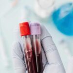Анализ крови на гормоны: какие гормоны можно определить?