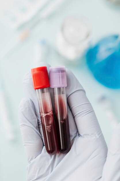Анализ крови на гормоны: что это?