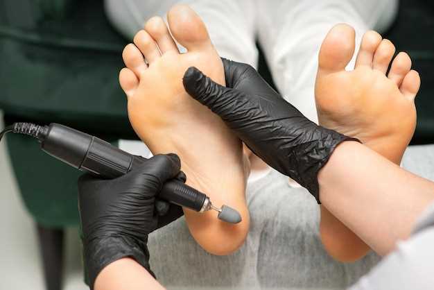 Как избавиться от черных полос на ногтях ног?