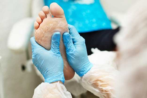 Лечение зуда на пальцах рук и ног