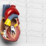 Эхокардиография сердца: определение, принцип работы и применение