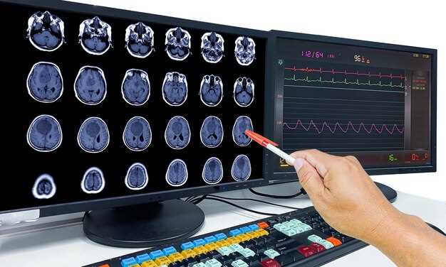 Области применения и возможности диагностики с помощью нейроносонографии