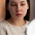 Герпес на лице: вызывающие факторы, признаки и эффективное лечение