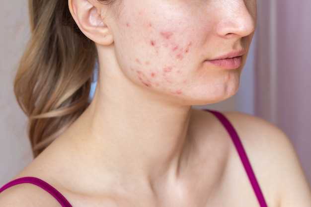 Типичные симптомы красных точек на коже