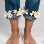 Как лечат варикоз на ногах: народные и медицинские методы лечения