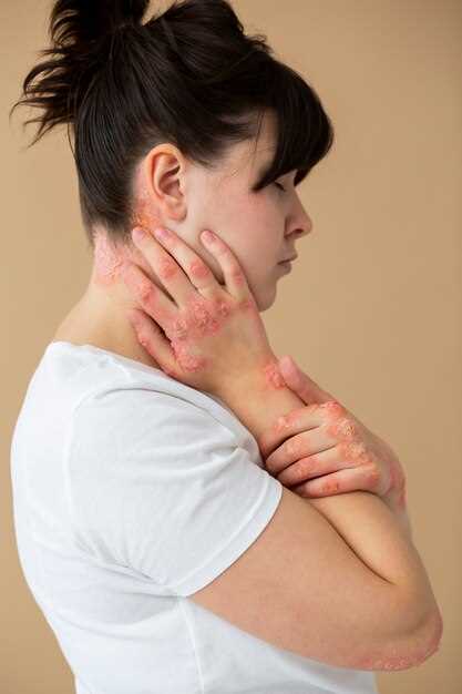 Причины воспаления лимфоузлов в паху у женщин и методы их лечения