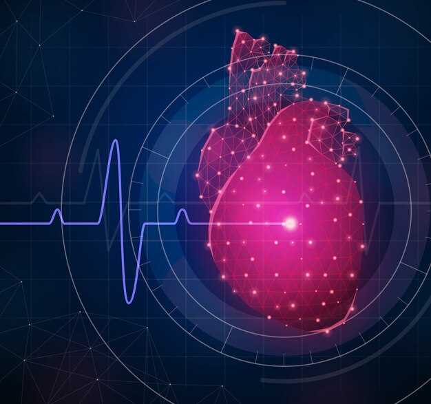 Симптомы и последствия обширного инфаркта миокарда