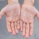 Почему чешется кожа на руках: причины и методы лечения