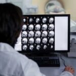Рентгеновские аппараты: устройство, виды и принцип работы