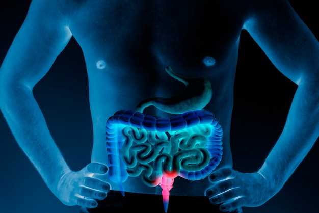 Синдром раздраженного кишечника: симптомы и эффективное лечение