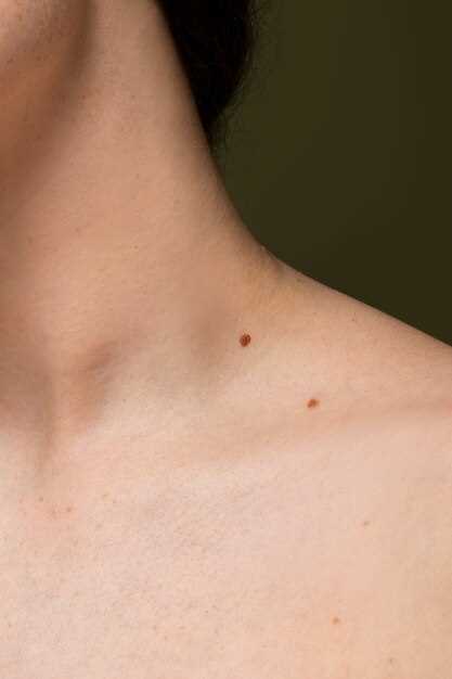 Средства лечения светло коричневых пятен на коже