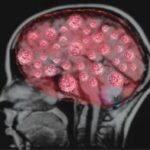 Таламический мозг: структура, функции, заболевания и лечение