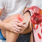 Тромбоэмболия нижних конечностей: причины, симптомы и лечение