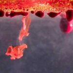 Симптомы низкого гемоглобина: как узнать свой уровень и что делать